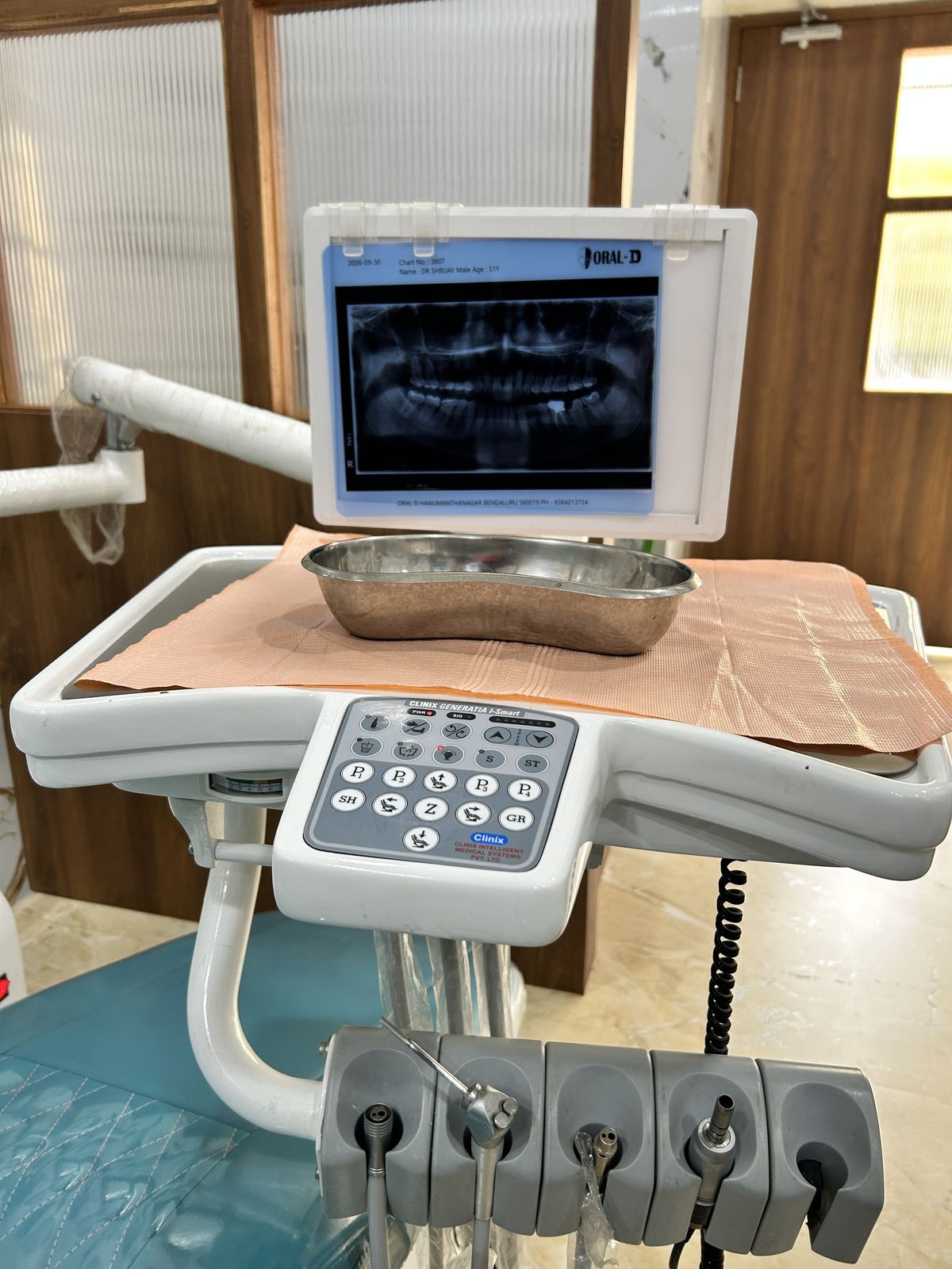 Digital X-ray display at the chairside